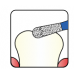 Osung Crown Posterior/ Occlusal Reduction Pear FG Shank 237-32F1 (237EX-26F) Fine Grit Diamond Bur 5/PK